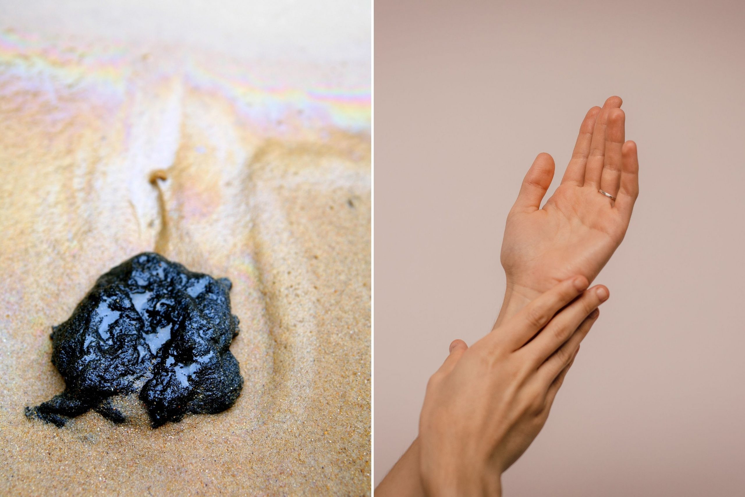 How to get tar off skin: Tips for hot sticky times